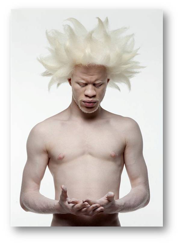 Photo-albinos-1.jpg
